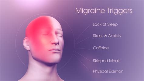 Migraine .